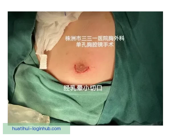 坎宁安气胸康复持续推进 活塞计划一周后复查评估